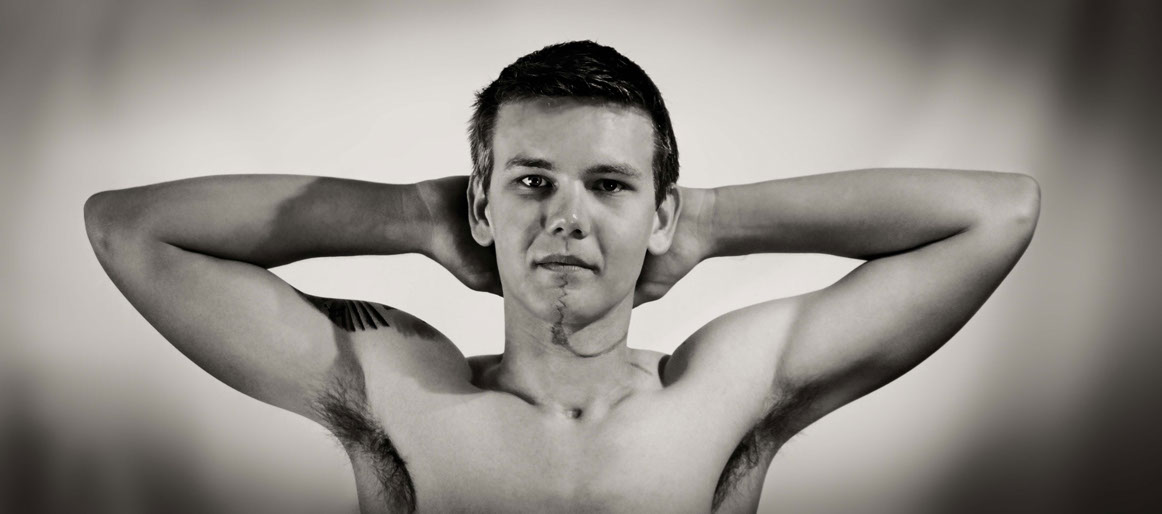 Scar Stories: Dave, tongue cancer survivor.
